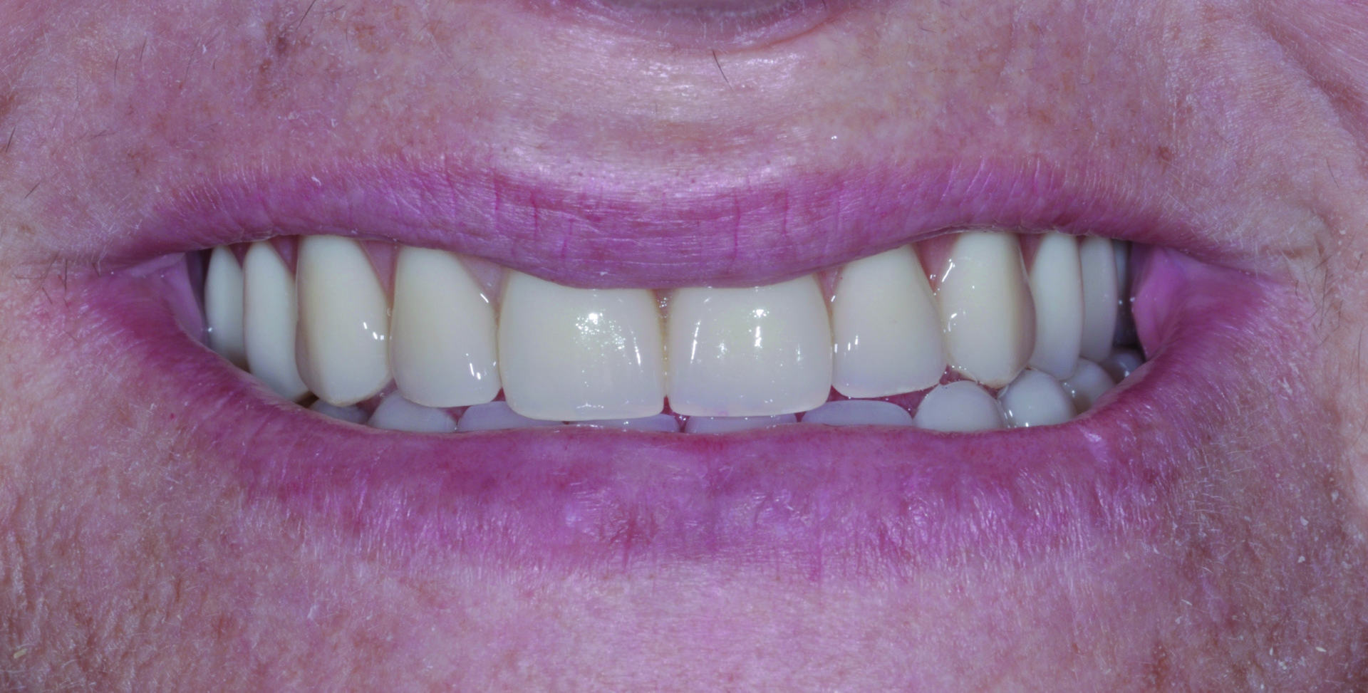 016-final-extra-oral