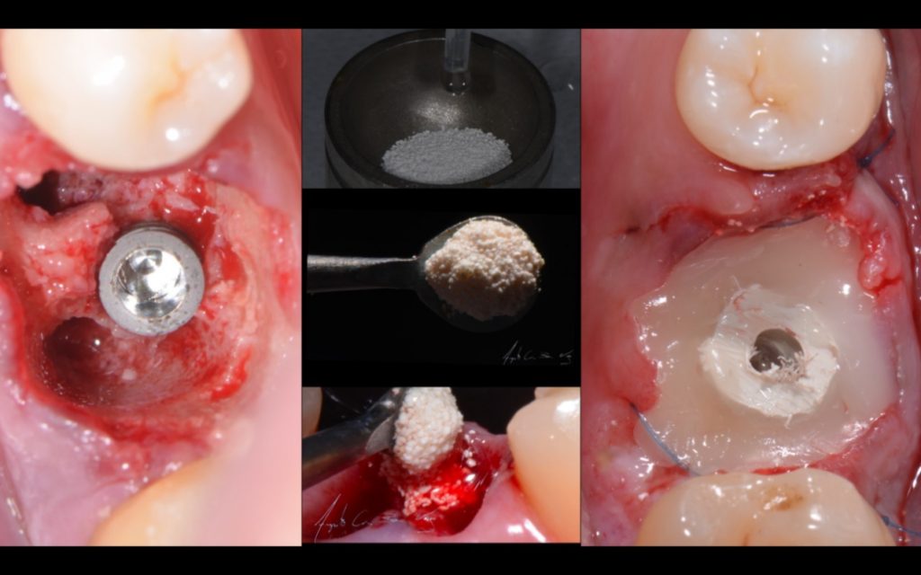 rehabilitación oral