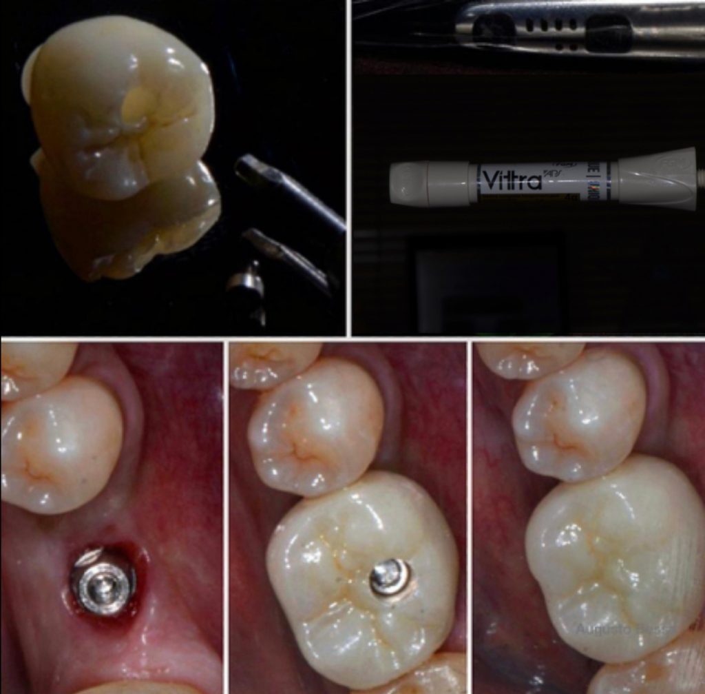 rehabilitación oral